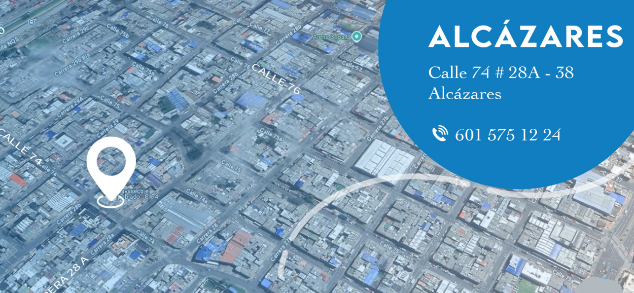 Alcázares